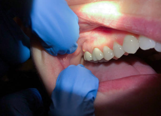 Best Pediatric Emergency Dentist in St David, AZ