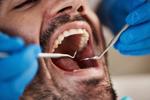Best Emergency Dental Care for Trauma or Injury in St David, AZ